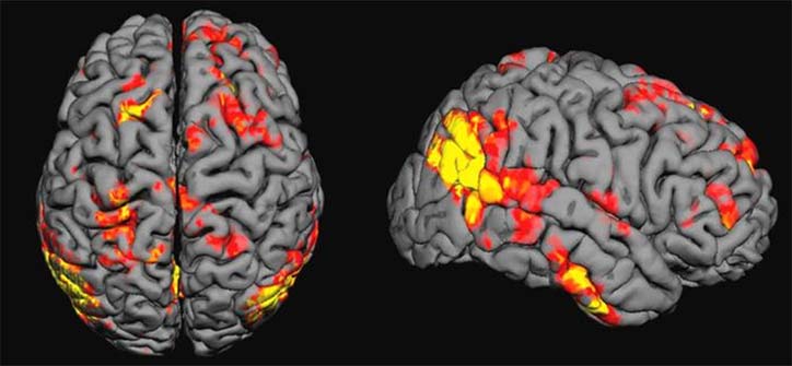 Активность мозга при выполнении различных заданий (исследование с помощью ФМРТ)
